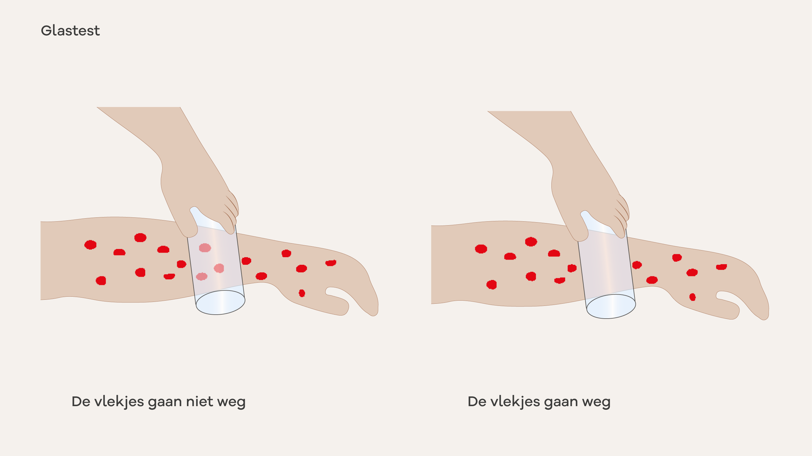 Illustratie van de glastest.