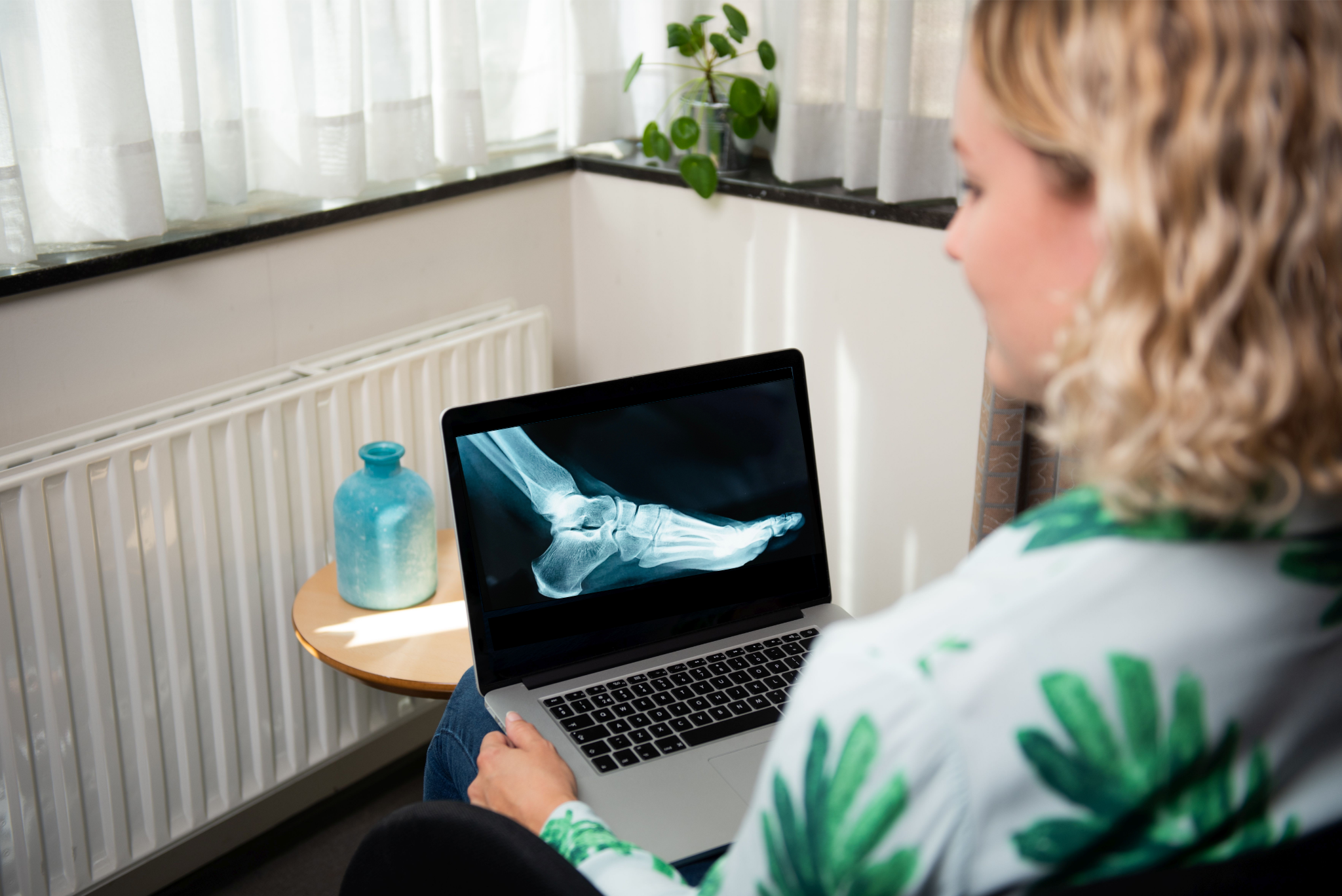 Laptop met beeld radiologie